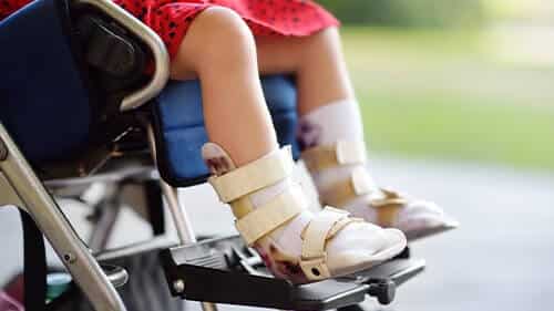 Ataxic Cerebral Palsy Lawsuit