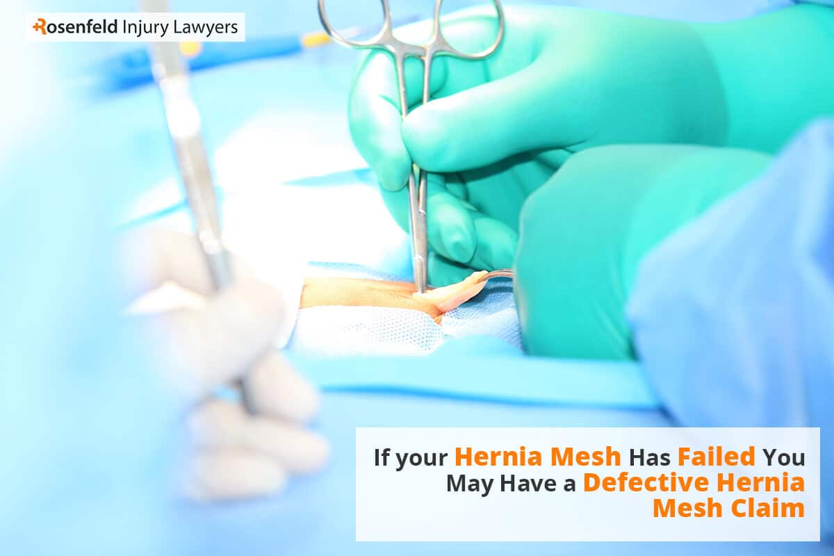 defective hernia mesh claim