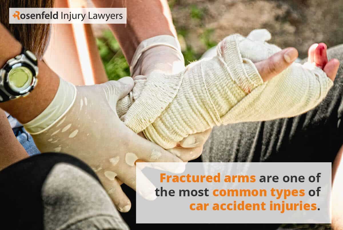 Fractured arms are one of the most common types of car accident injuries.