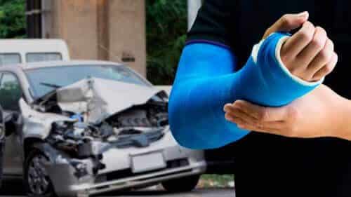 man-broken-hand-cast-car-accident