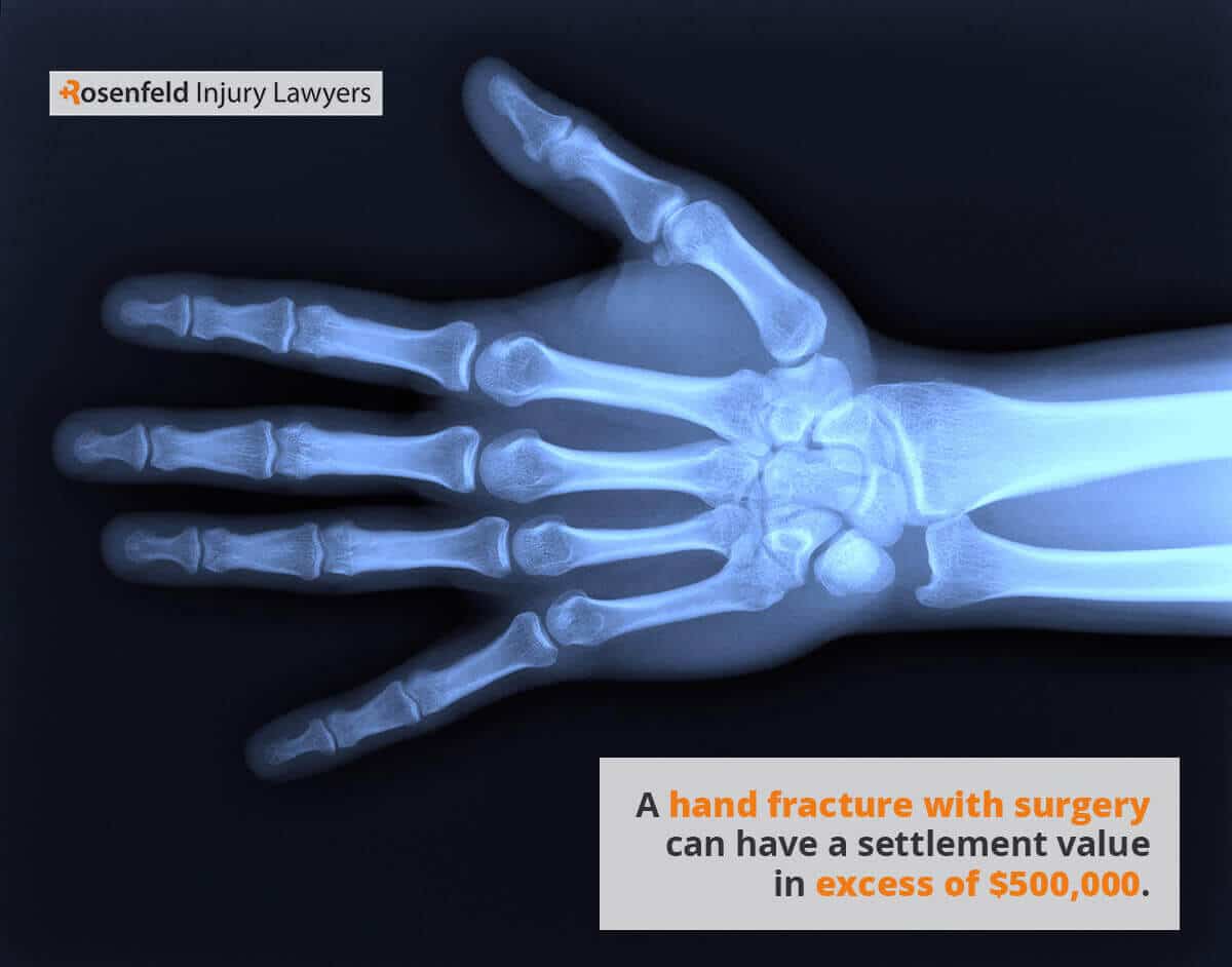 Some hand and wrist injury cases can have additional value when future surgery is required.