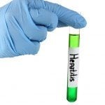 Hepatitis A Food Poisoning