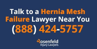 talk to hernia mesh attorney
