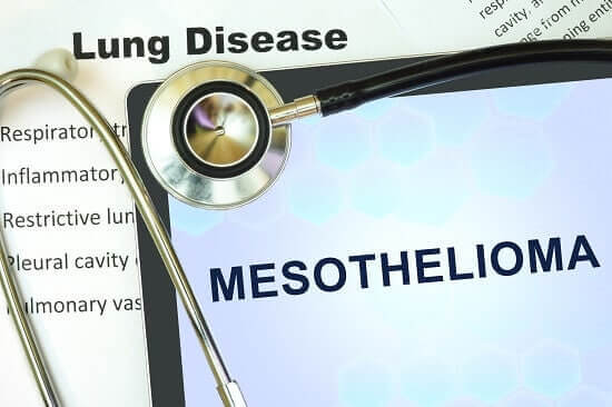 mesothelioma exposure to asbestos lawyer