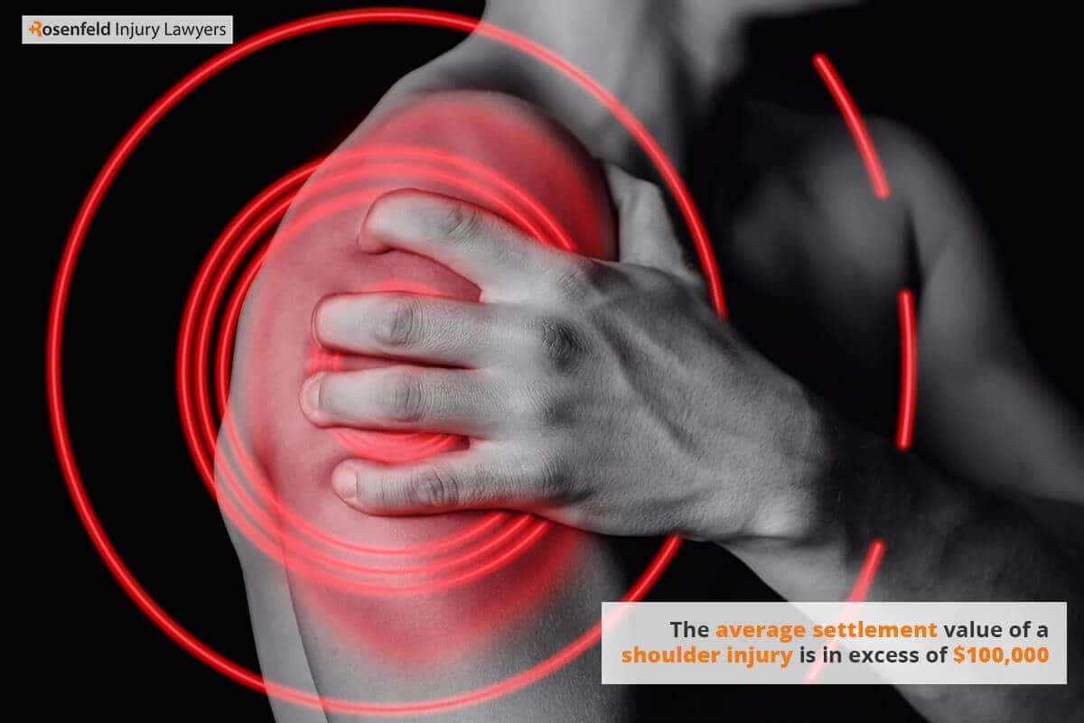 The value of a shoulder injury can increase dramatically when surgery is required.