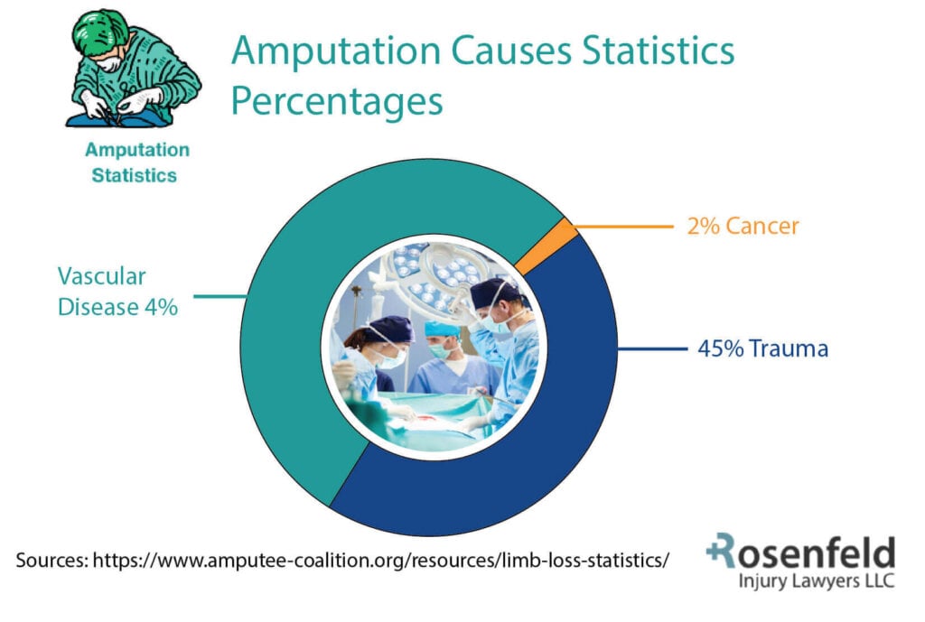 Amputation Statistics Reveals 45% of All Amputations are Due to Trauma