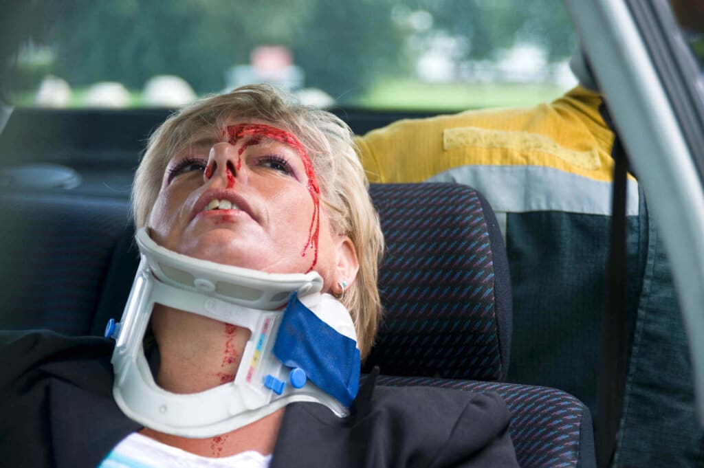Lacerations in Truck Accident Lawsuits