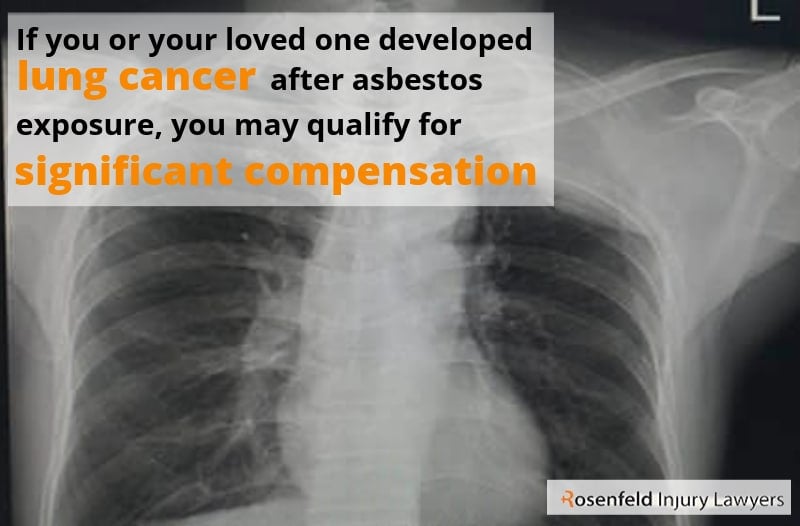 If you or your loved one developed lung cancer after asbestos exposure, you may qualify for significant compensation.
