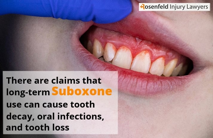 There are claims that long-term Suboxone use can cause tooth decay, oral infections, and tooth loss